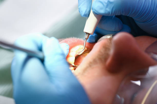 Best Root Canal Emergency Dentist  in Stony Point, NC