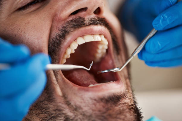 Best Dentist for Tooth Abscess  in Stony Point, NC